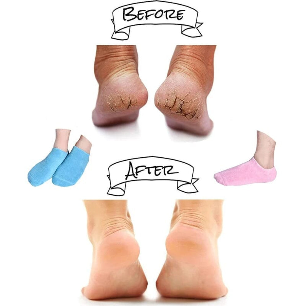 Moisturizing Socks with Gel Lining - Image 6
