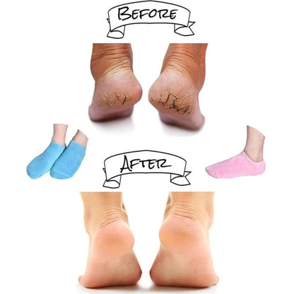 Moisturizing Socks with Gel Lining - Image 6